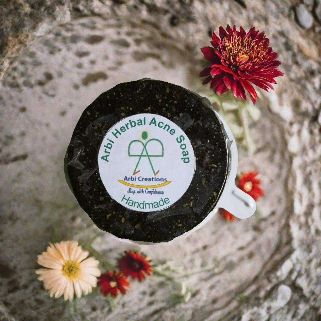 Herbal Acne Soap (Handmade)